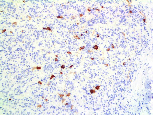 IHC of TSH on an FFPE Pituitary Tissue